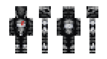 Skin etiohs