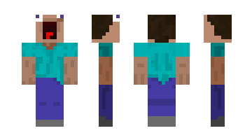 Skin tim4